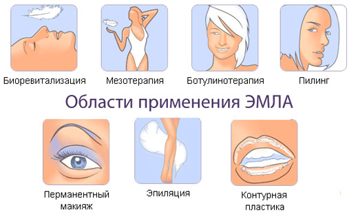 Чи є аналоги крему ЕМЛА, які від них відчуття?