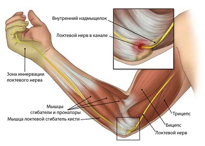 Німіє мізинець лівої руки. Що робити?