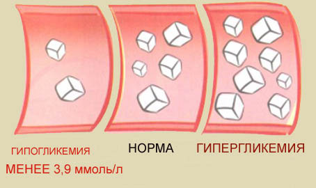У якій кількості і взагалі можна вживати шоколад діабетикам?